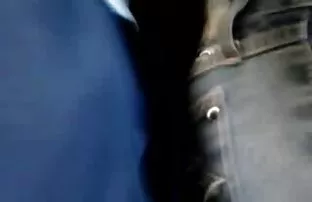 XXX Phụ nữ đẹp trẻ lông mu